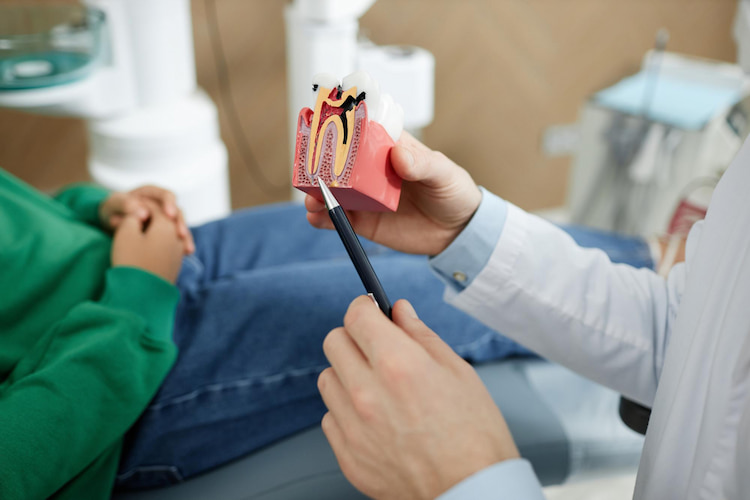 a dentist is holding a tooth model, showing how root canal works for a patient.
